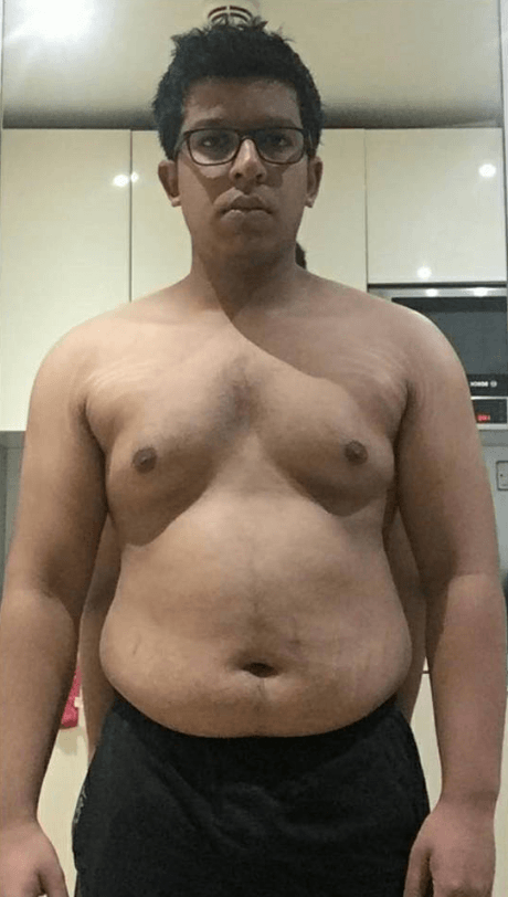 Anand Before